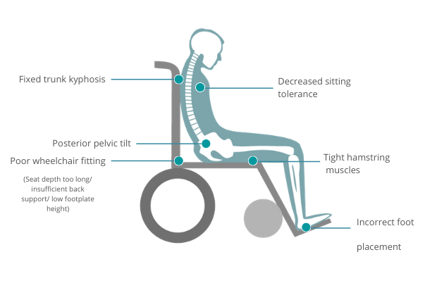 What Happens to the Elderly User if the Seat Depth of the Wheelchair Is Too  Deep?
