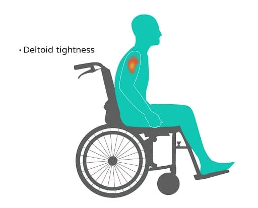 deltiod tightness